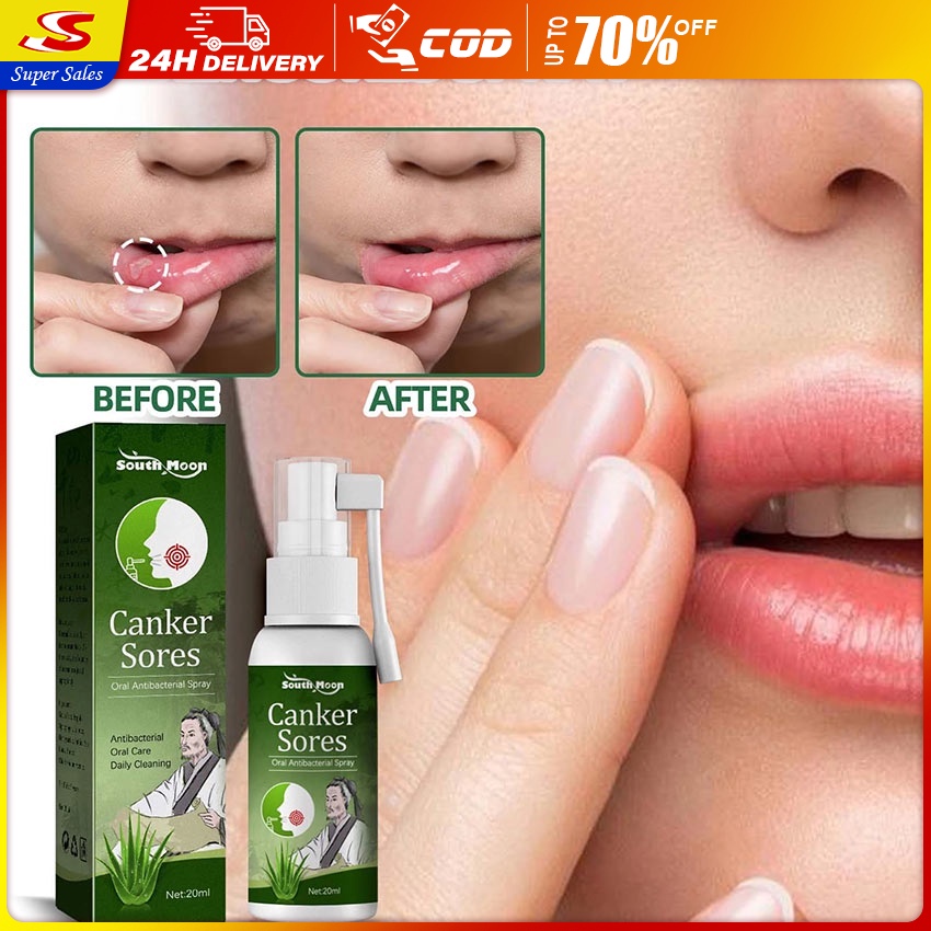 Shop spray for sore throat for Sale on Shopee Philippines