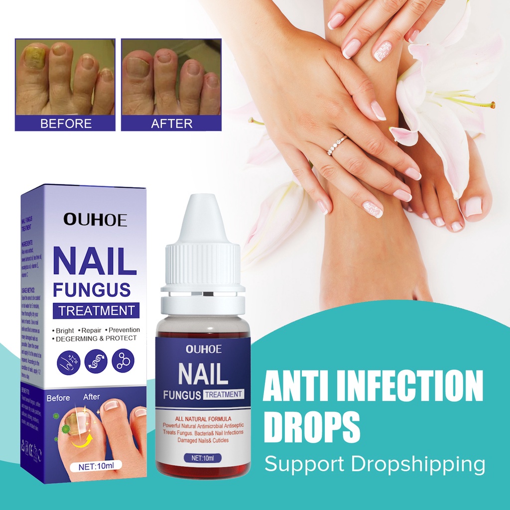 OUHOE Nail Fungus Treatment Nail Antiinfection Drops Repair Cracking
