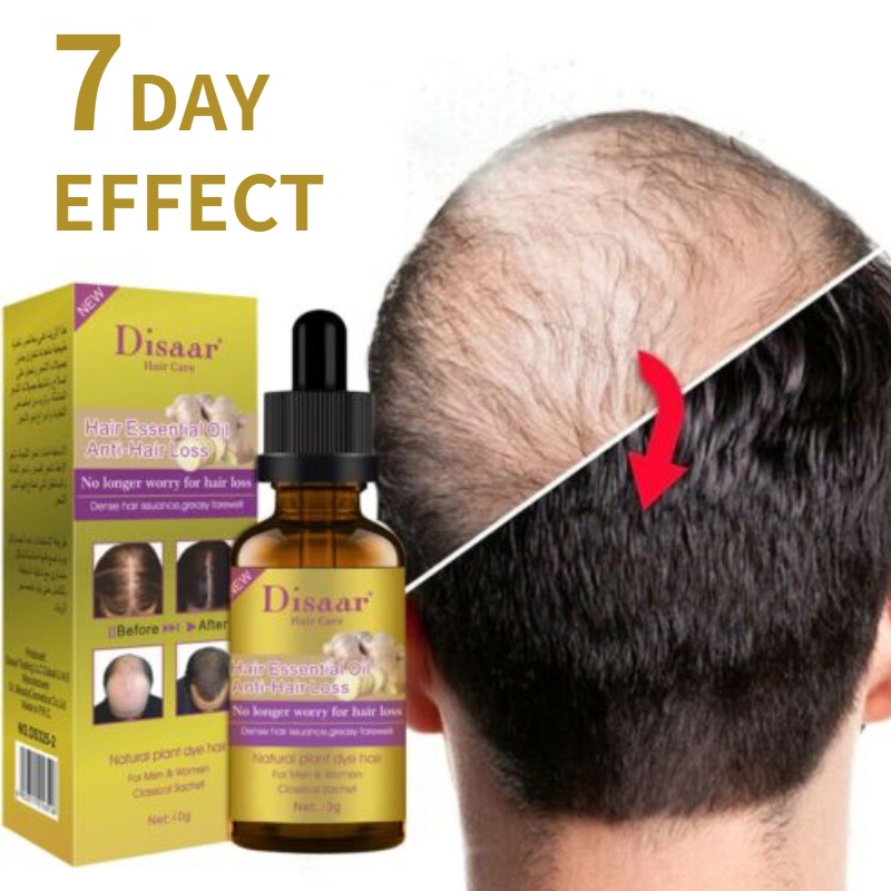 Ginger Hair Growth Essence Oil Hair Grower Serum Spray Anti Hair Loss