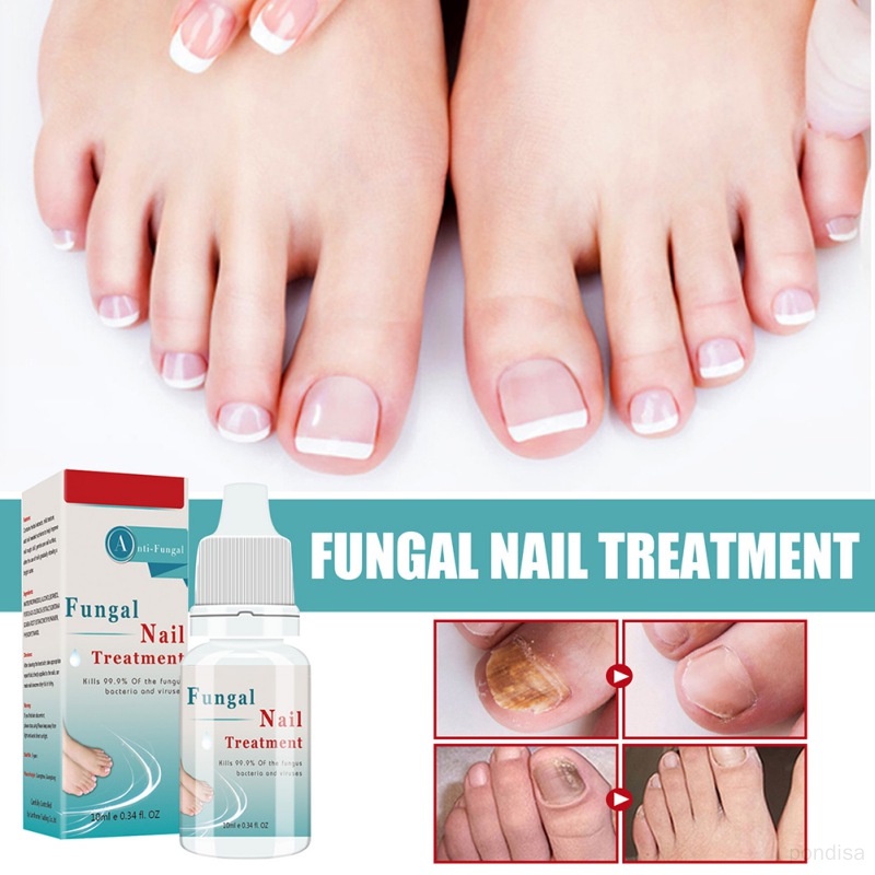 Nail Fungus Repair 10ml Nail Repair Strengthening Unhealthy Nails Care