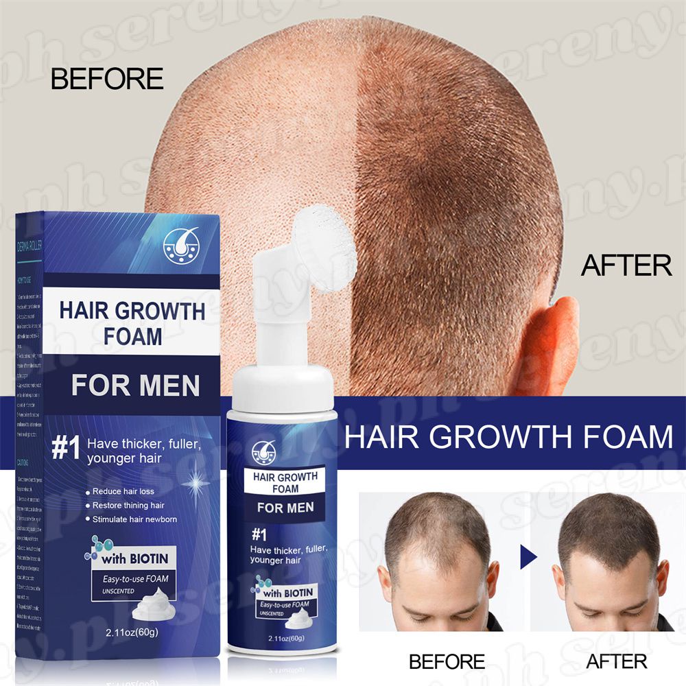 Fast Hair Growth Foam Minoxidil Hair Growth Serum Hair Grower Foam For Man And Woman Hair Loss 