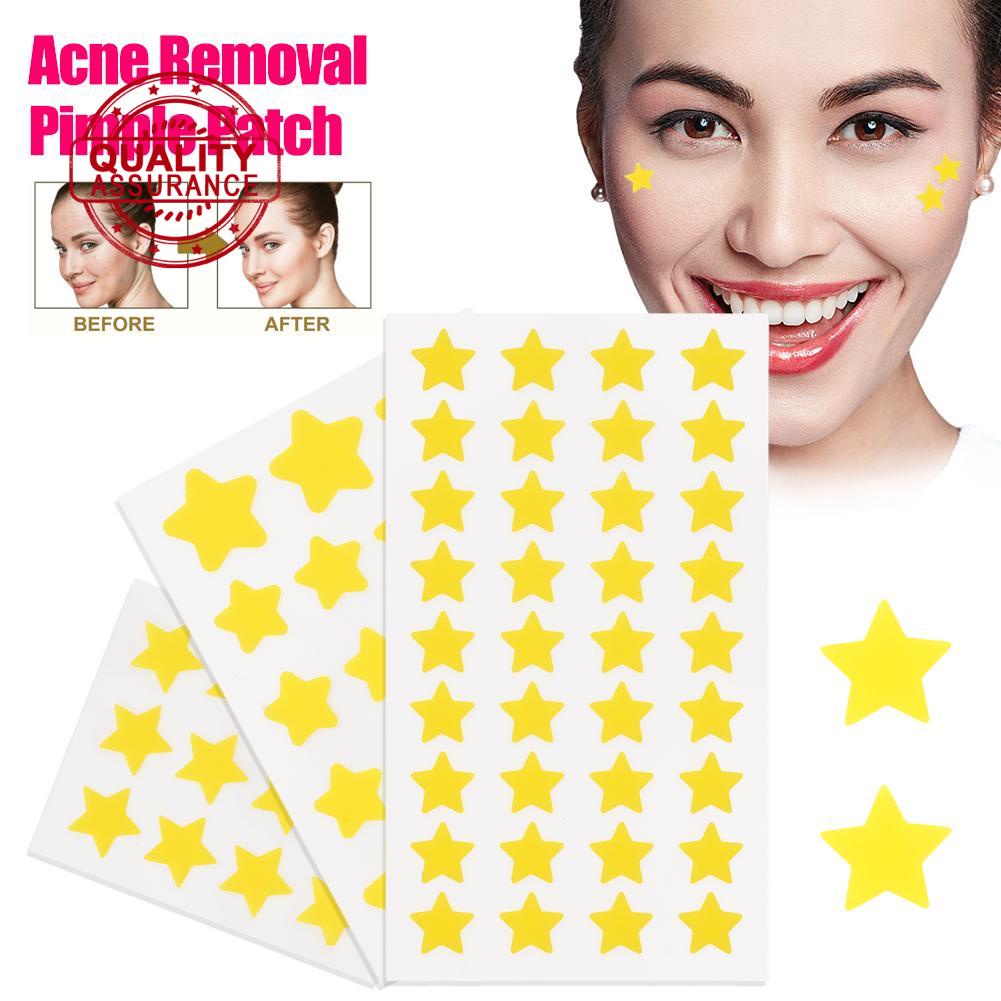 12pcs/18pcs/36pcs Yellow Star Acne Stickers Breathable Removal Patch ...