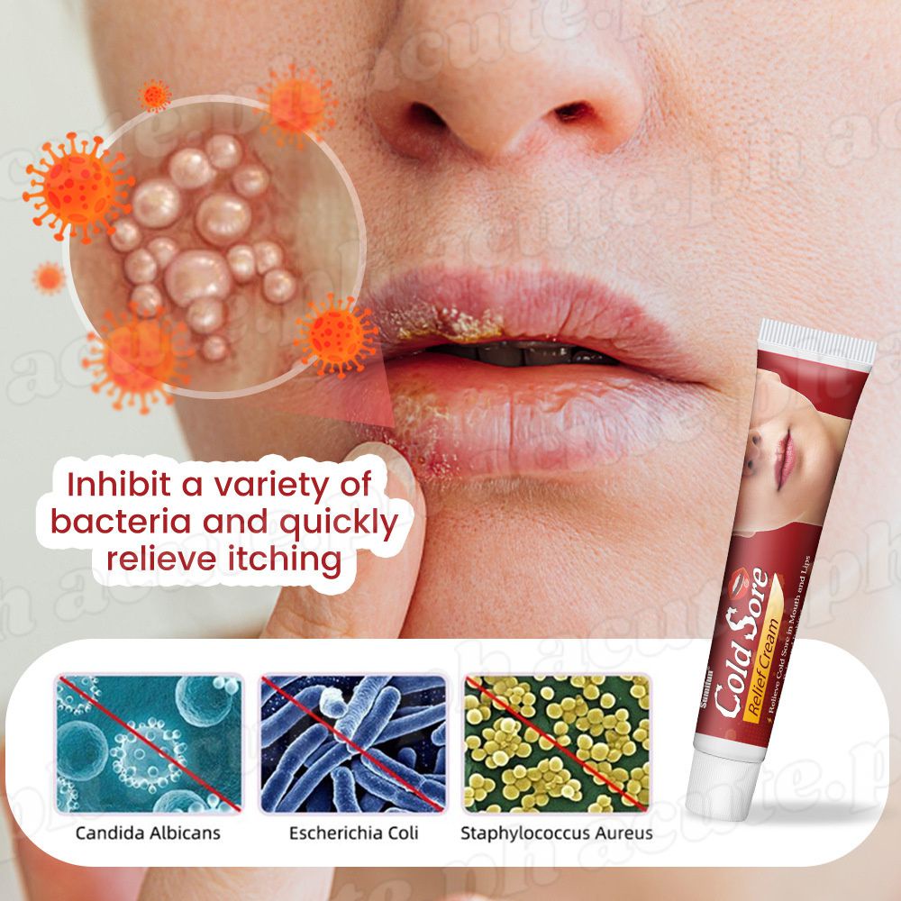 Cold Sore Relief Cream Cheilitis Lips Relief Cream Repair Lip Dry