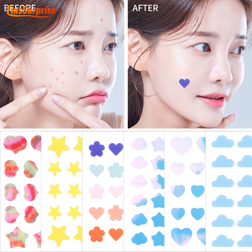 Creative Facial Concealer Acne Removal Sticker Fade Spots and Repair ...