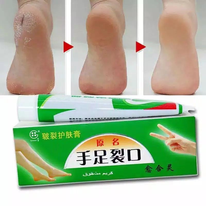 Proven Effective Medicine CREAM Ointment Heel Cracked, Dry, Thick ...