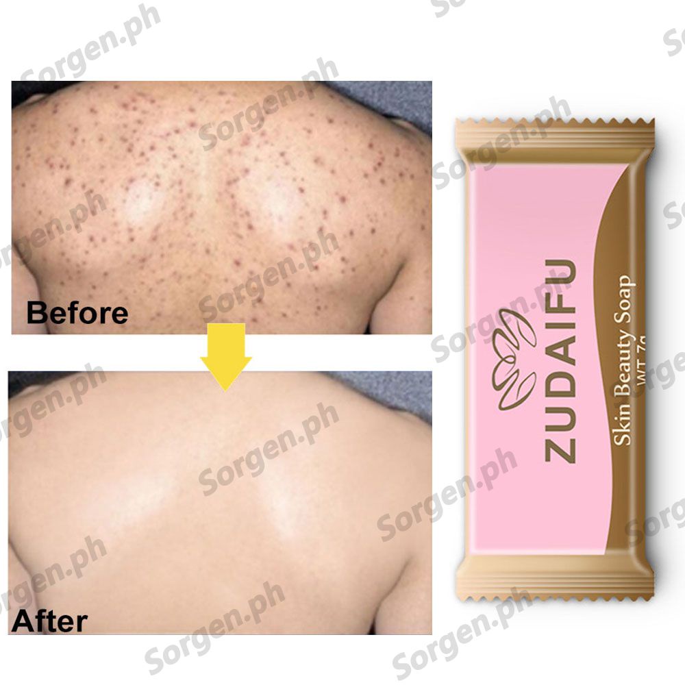 Highly Effective Gentle And Soothing Rash Treatment Moisturizing Rash Eczema Relief Clinically