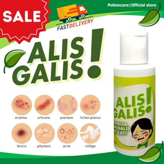 Alis Galis Skin Itching Fungal Ringworm Dermatitis gamot sa kati-kati ...