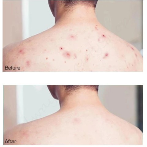 SOMEBYMI AHA BHA PHA 30 Days Miracle Cleansing Bar Soap | Shopee ...