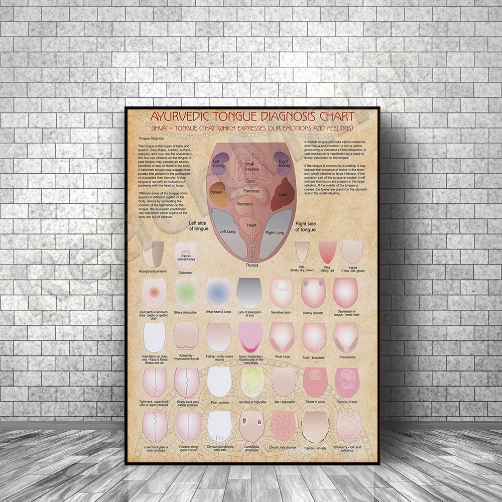 Ayurveda Tongue Diagnosis Diagram Vertical Poster, Tongue Health Wall Art, Ayurveda Healing Wall