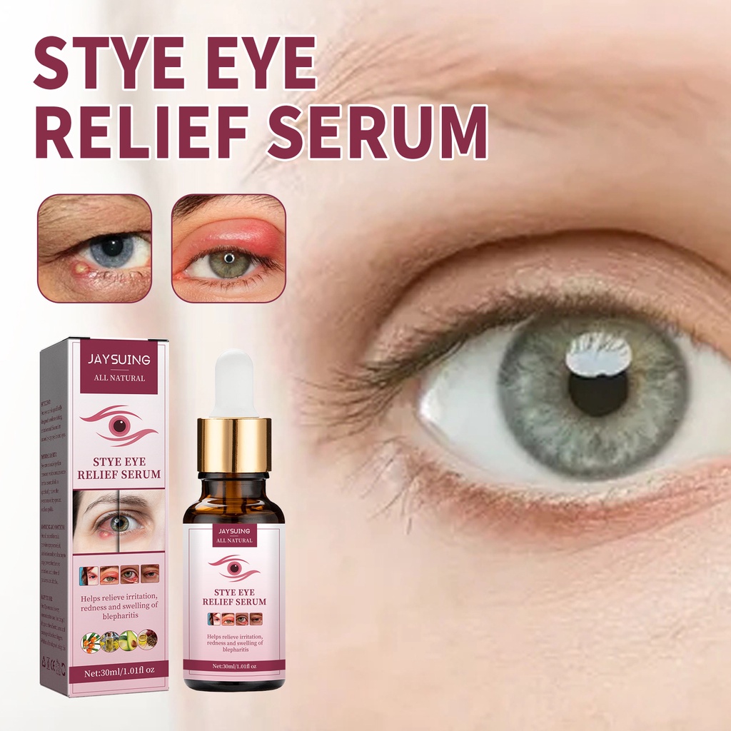 Stye Eye Treatment Eye Stye Remover Chalazion Remover Stye Eye Relief Serum For Styes 4095