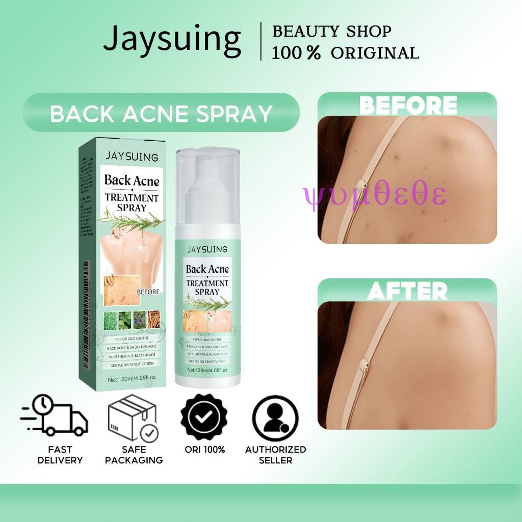 【yuyuyum】jaysuing Back Particles Eliminate Acne Care Spray mite Back ...