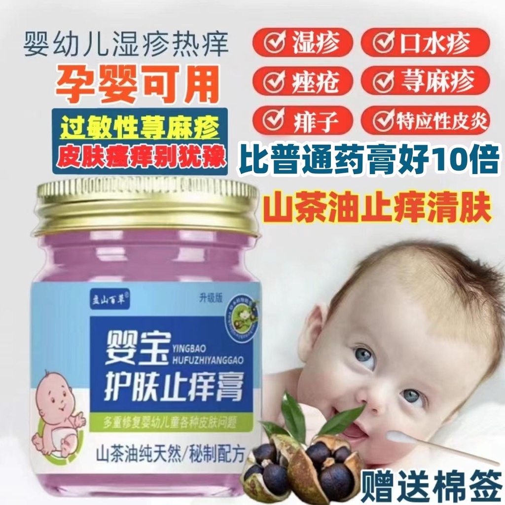 Tik Tok Crash Style Baby Skin Care Antiitch Cream Mosquito Bite
