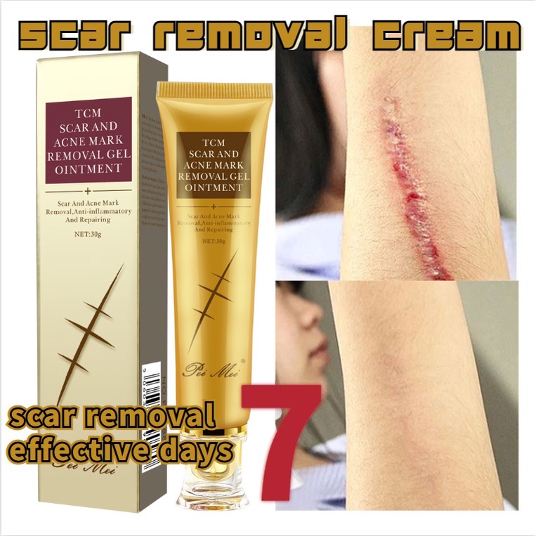 Peklat Scar Remover Cream Old Scar Removal Gel Stretch Mark Remover For Face Scald Burns Treat