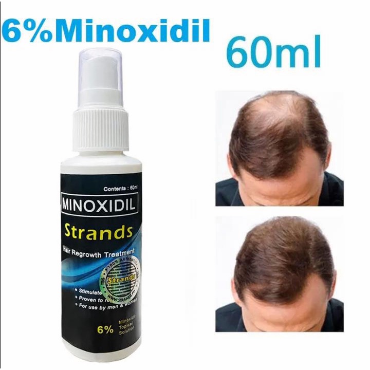 Minoxidil Strands 6% Minoxidil Topical Solution (60ml per bottle