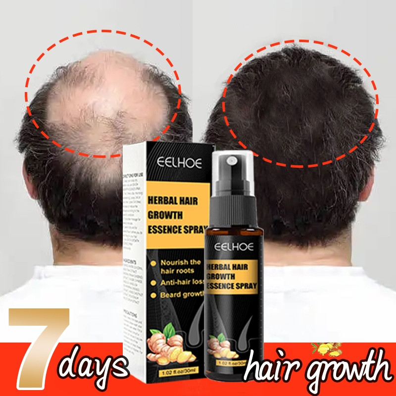 7 Days Fast Hair Growth Hair Grower For Men Original Minoxidil Regrow ...