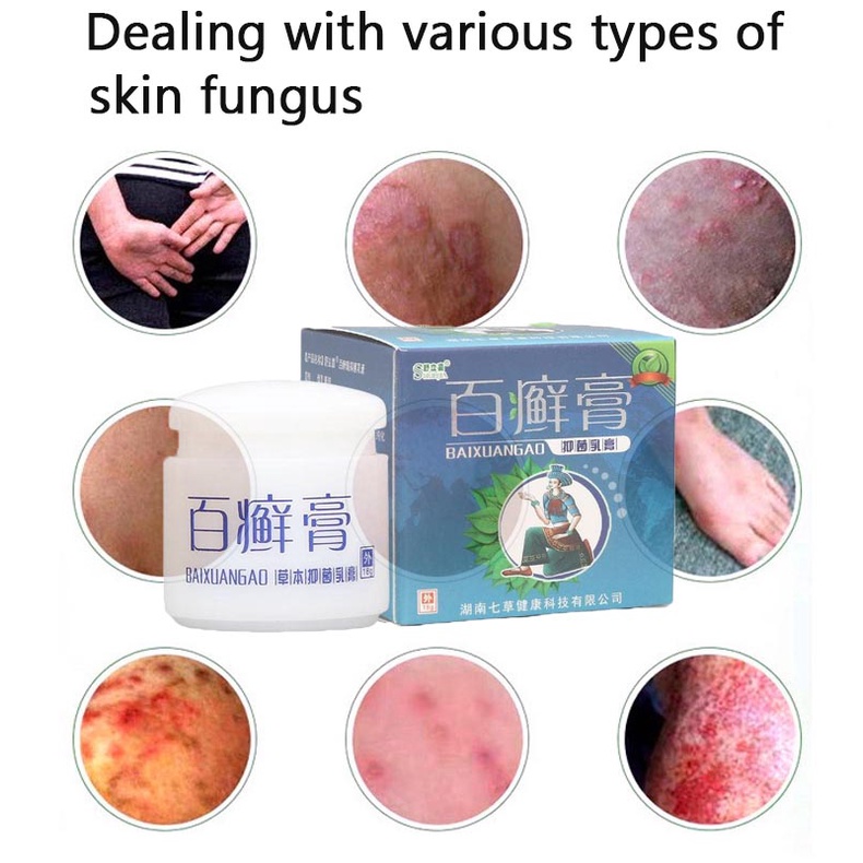 Chinese herbal antimicrobial cream for fungal and bacterial infections, ulcers, psoriasis