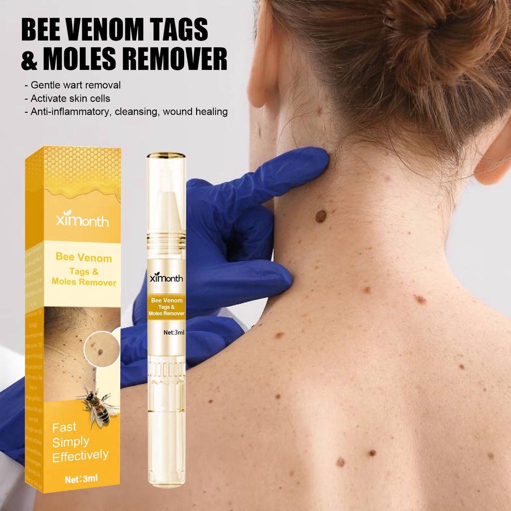 Bee Venom Tags Moles Remover Wipe Off Skin Tag Remover Easy To Use