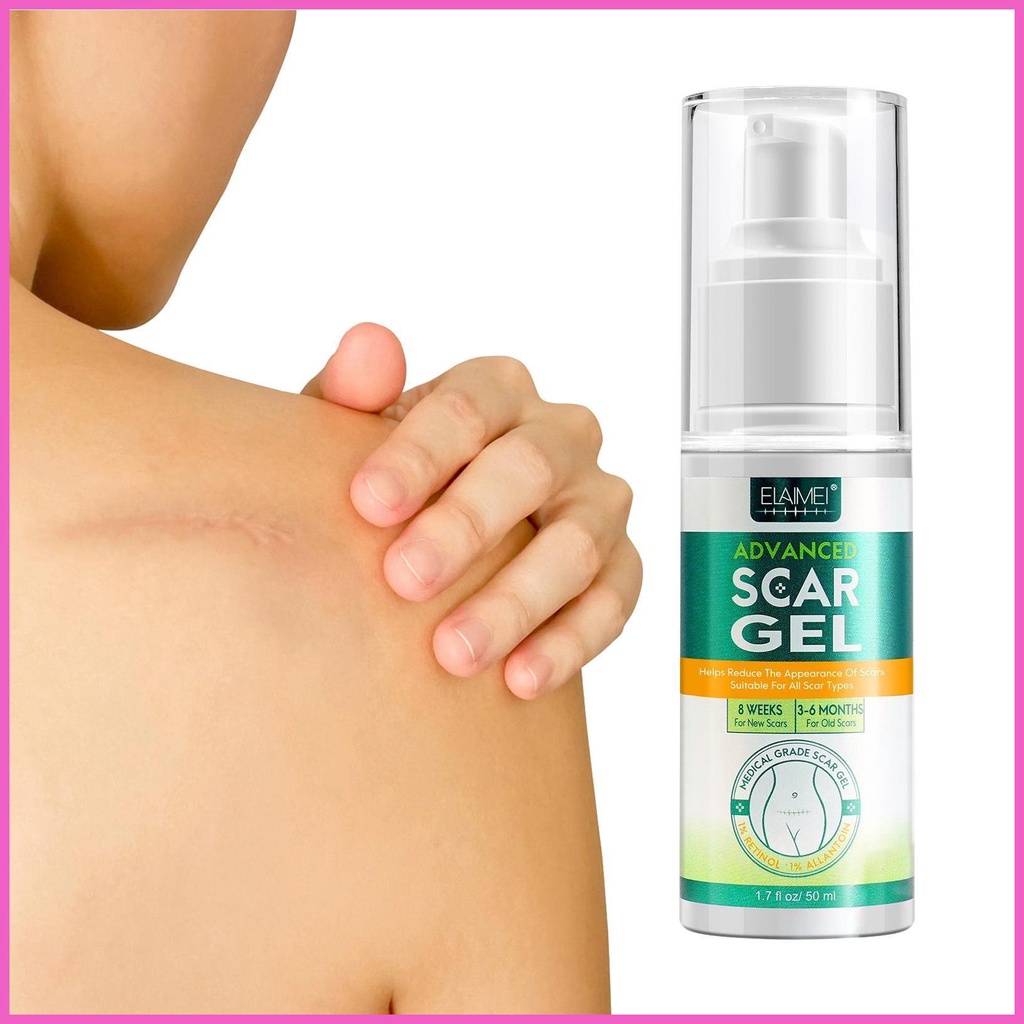 Scar Repair Gel 50ml Effective Scars Repair Cream Repair Scar Slack