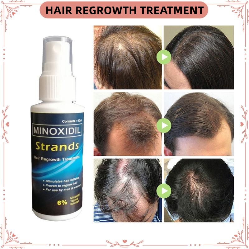 Minoxidil Strands 6% Minoxidil Topical Solution Hair Grower beard  Growerminoxidil 60ml