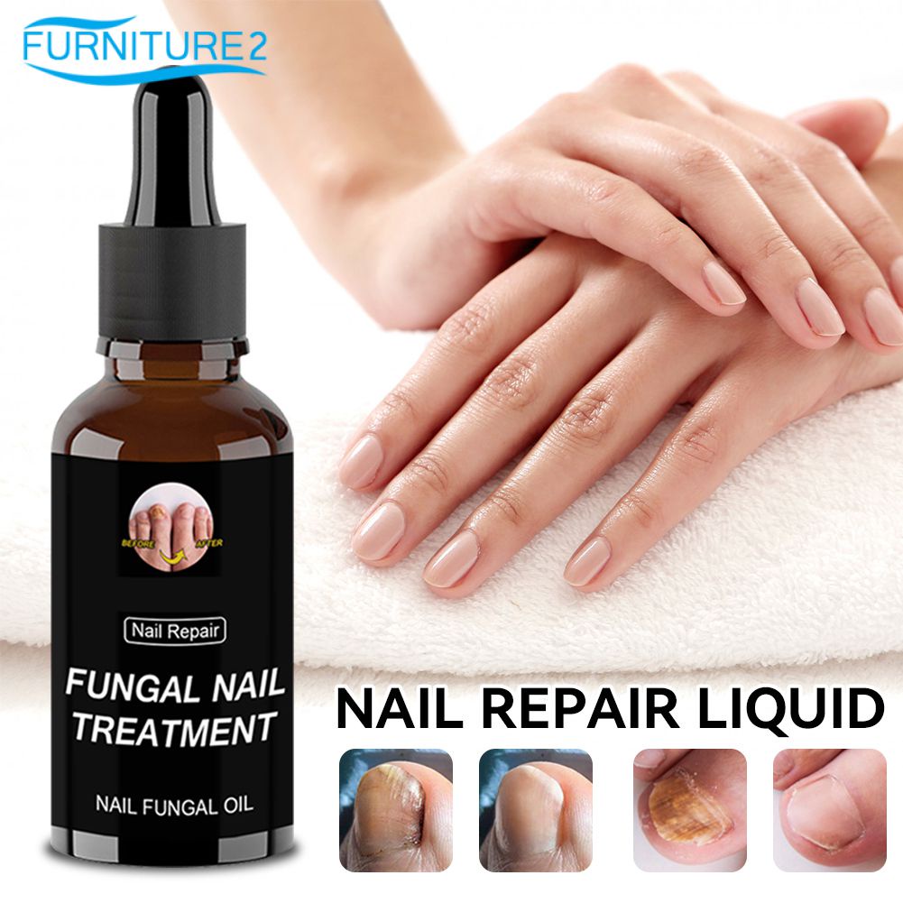 Eelhoe Nail Repair Serum Foot Repair Essence Gel Removing Fungal Nail ...