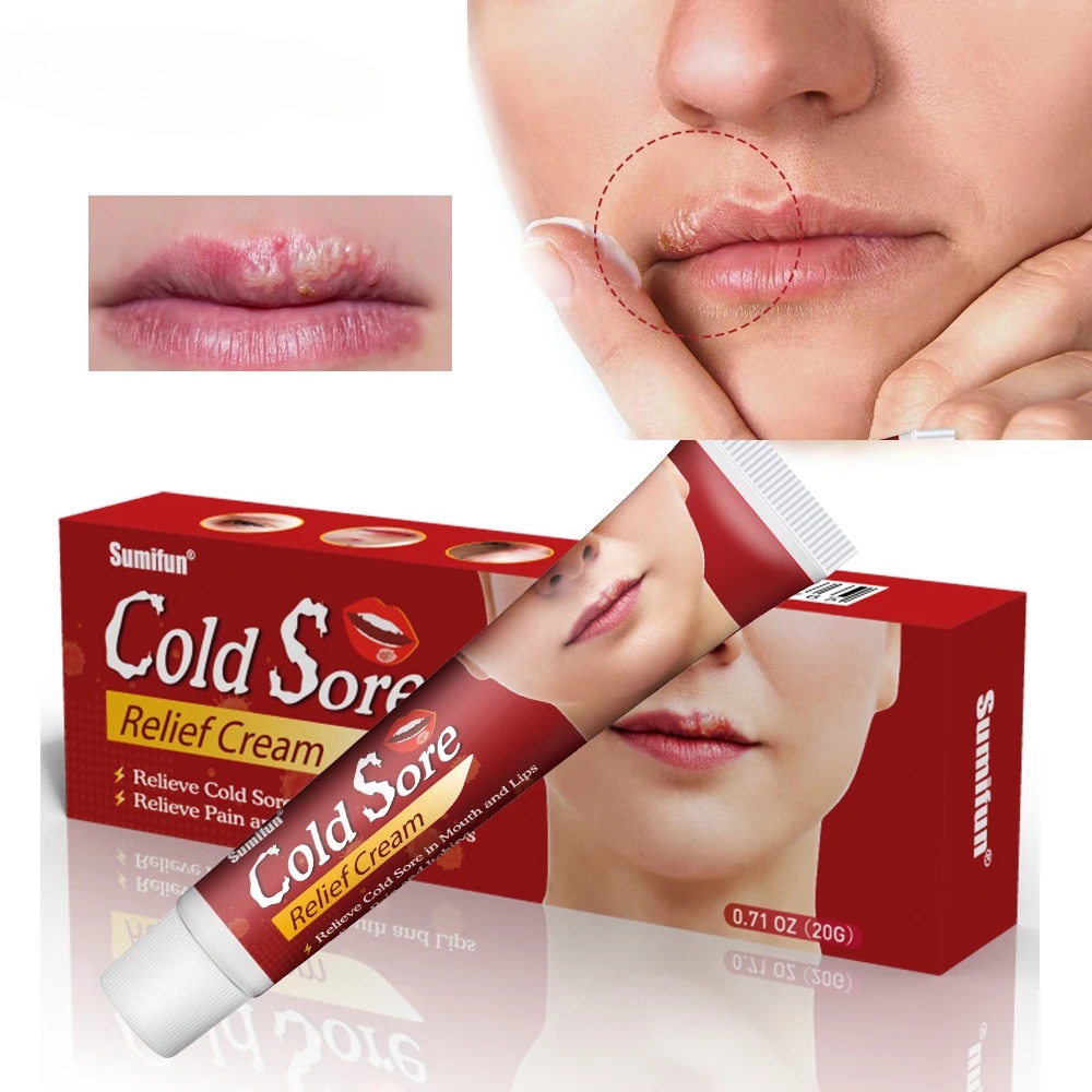 Cold Sores Lip Cheilitis Treatment Cream Herpes Antibacterial Ointment
