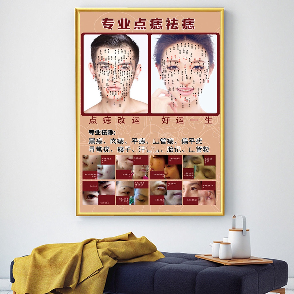 12.22 Dot Mole Chart Facial Advertising Painting Mole Removal Picture ...