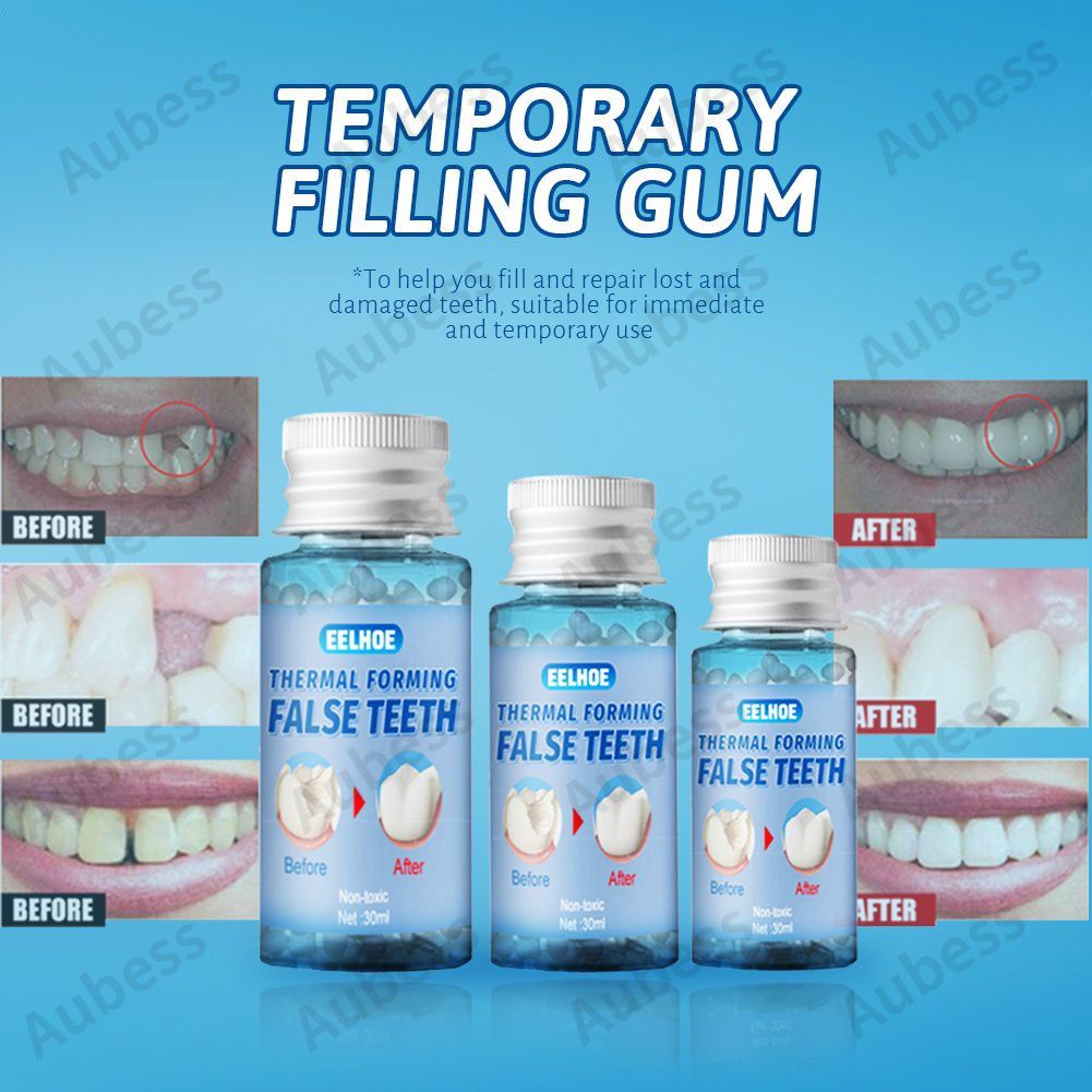 10g/20g/30g Temporary Tooth Restoration Kit Glue Denture Teeth And Gaps ...