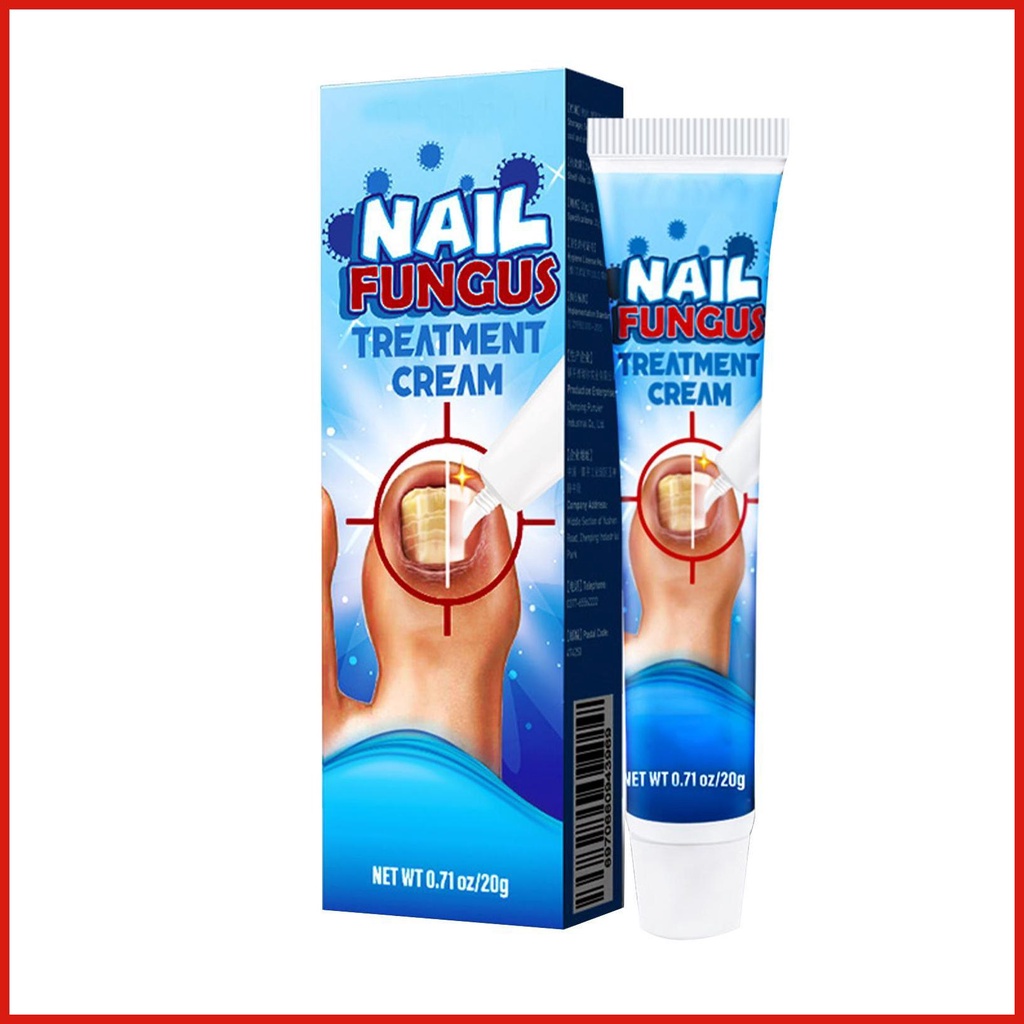 Anti Fungal Foot Cream Foot Antifungal Cream 0.71oz Effective Toenail ...