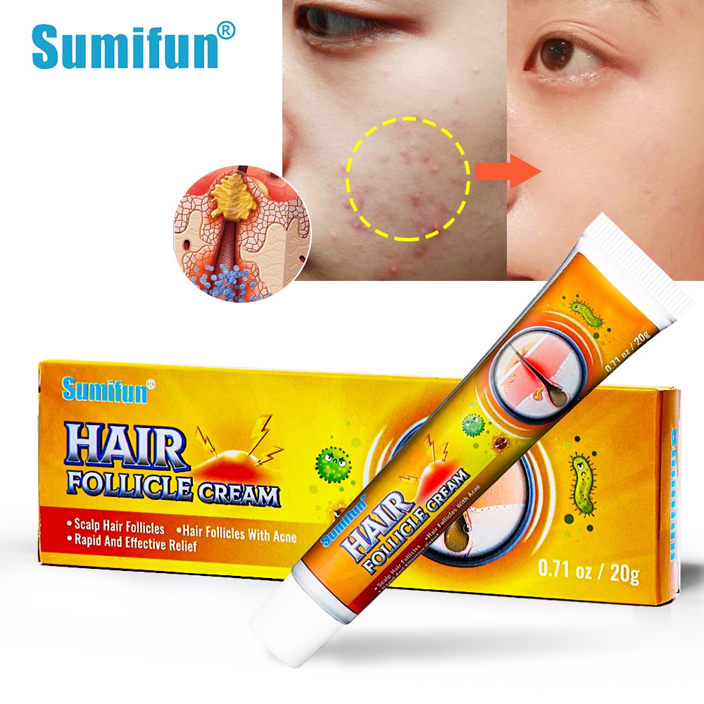 sumifun-folliculitis-cream-scalp-hair-folliculitis-medicine-spot