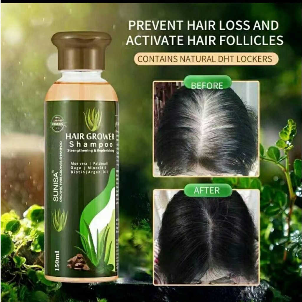 Authentic Hair Grower Aloe Vera Shampoo Strengthening & Replenishing 150ml  | Shopee Philippines