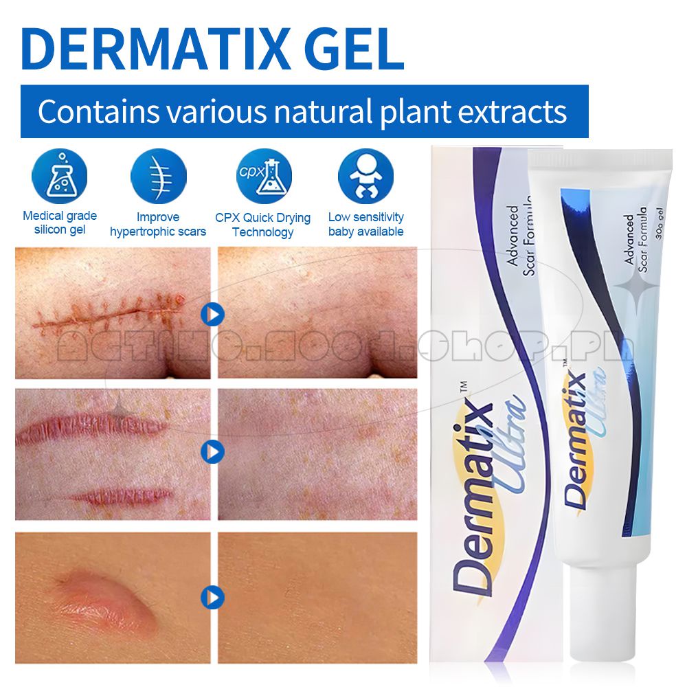 Dermatix Ultra Scar Gel 15g Scar Reduction Cream Remove Fade Scars