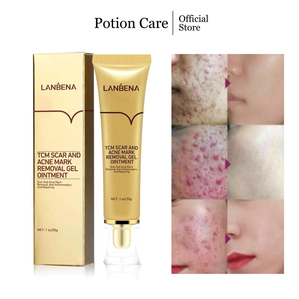 LANBENA TCM Scar and Acne Mark Removal Gel Ointment Skin Damage Repair