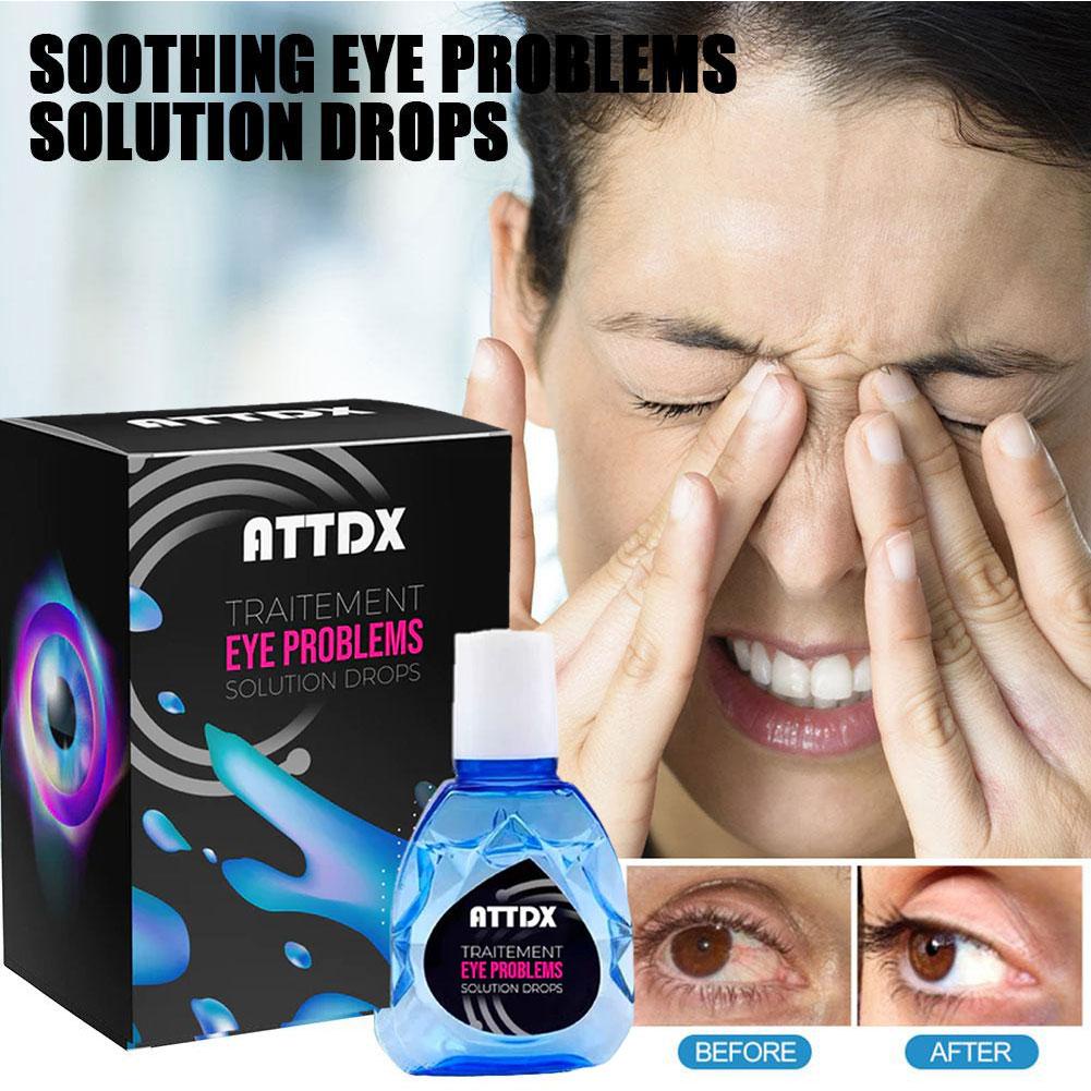 Eye Drops Itchy Relieves Dry Eyes Sore Red Eyes Eye Drops Shopee Philippines