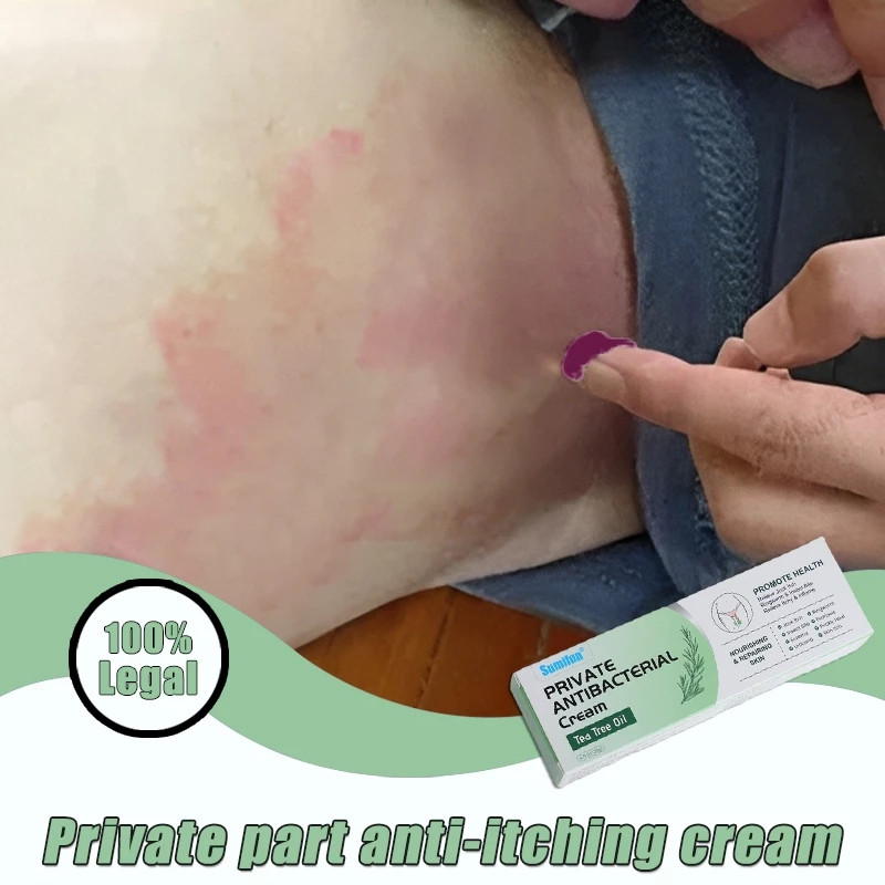 Anti Fungal Cream For Private Antibacterial Ointment 20g | Shopee ...