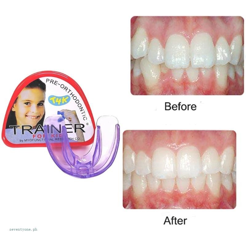 【seve*】 Children Dental Tooth Orthodontic Retainers Appliance Trainer
