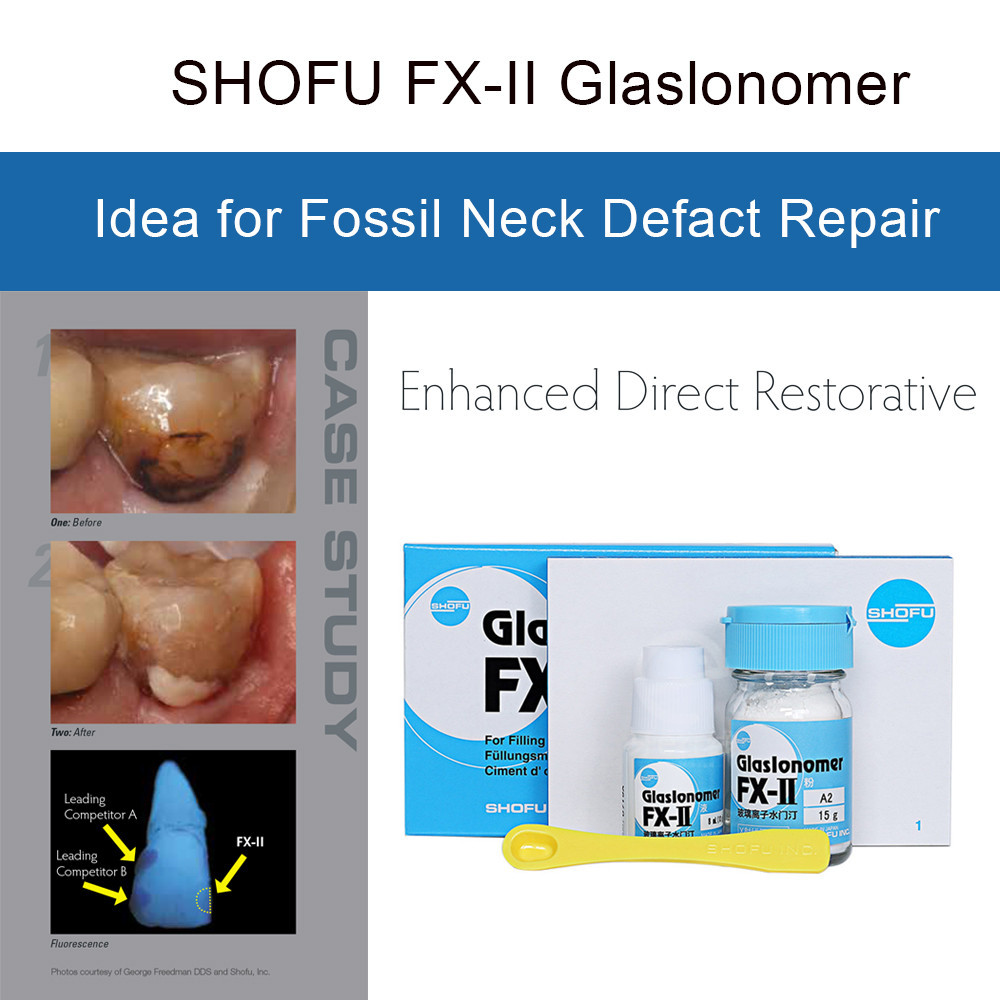 HoubIII Original Dental Supplies ShoFu FXII Glaslonomer Cement Gic
