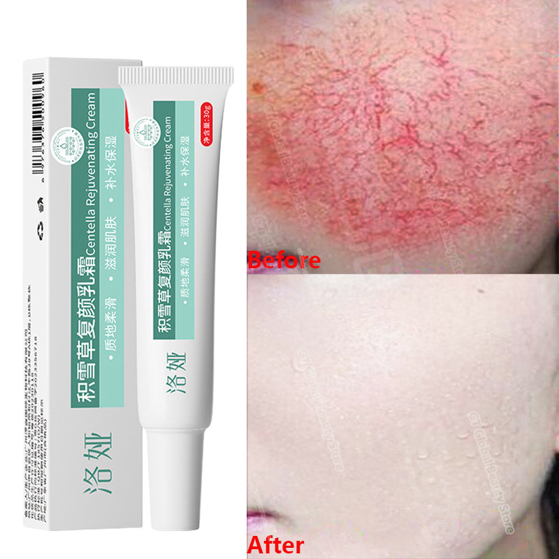 Fast Repair Facial Redness Cream Sooth Itching Sensitive Skin Improve