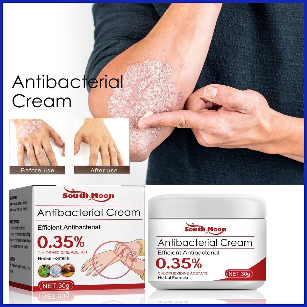 Psoriasis Cream Eczema Cream Antifungal Cream Gatal Eczema Scabies