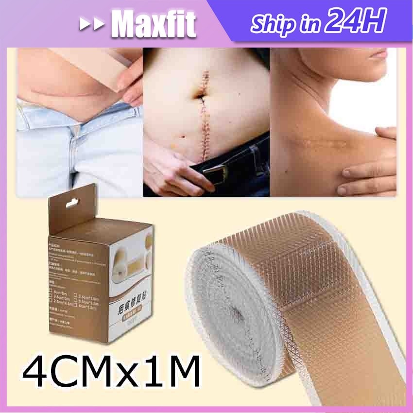 Silicone Scar Sheet Scar Removal Patch Sticker Scar Removal Silicone ...