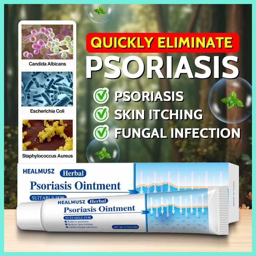 Psoriasis,W+Cream^Sj