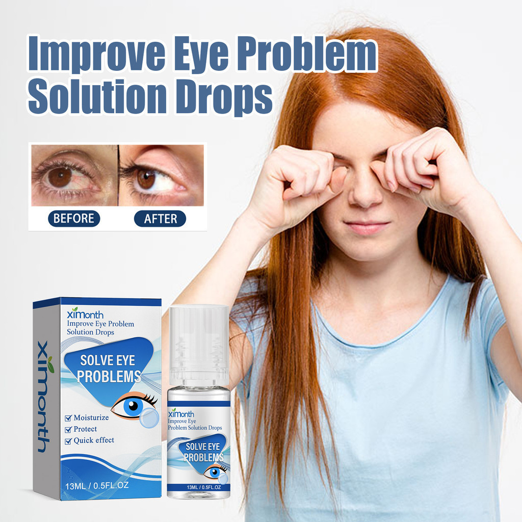Myopia Eye Drops Relieve Eye Fatigue, Soreness, Redness and Swelling