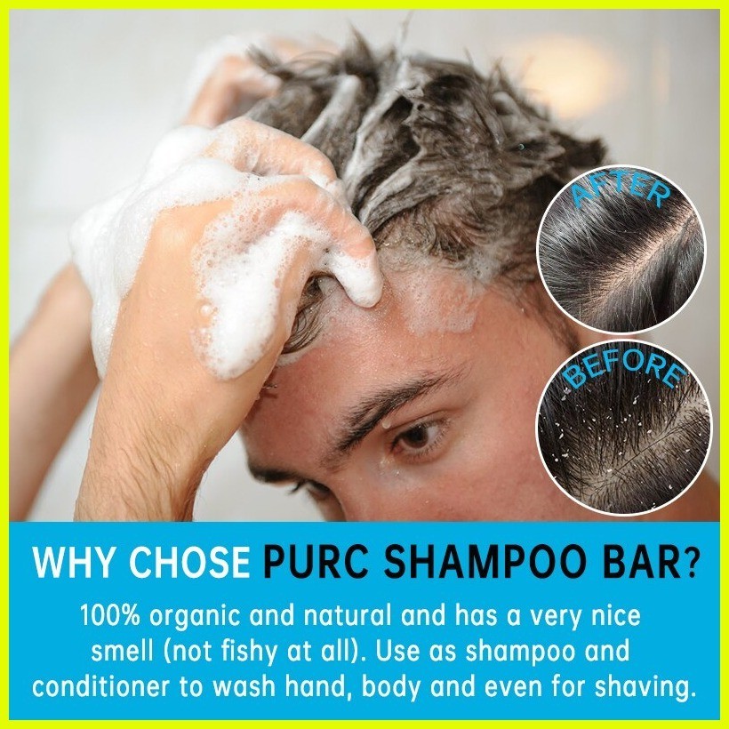 ♞sea Salt Shampoo Oil Control Anti Dandruff Shampoo Psoriasis For Scalp