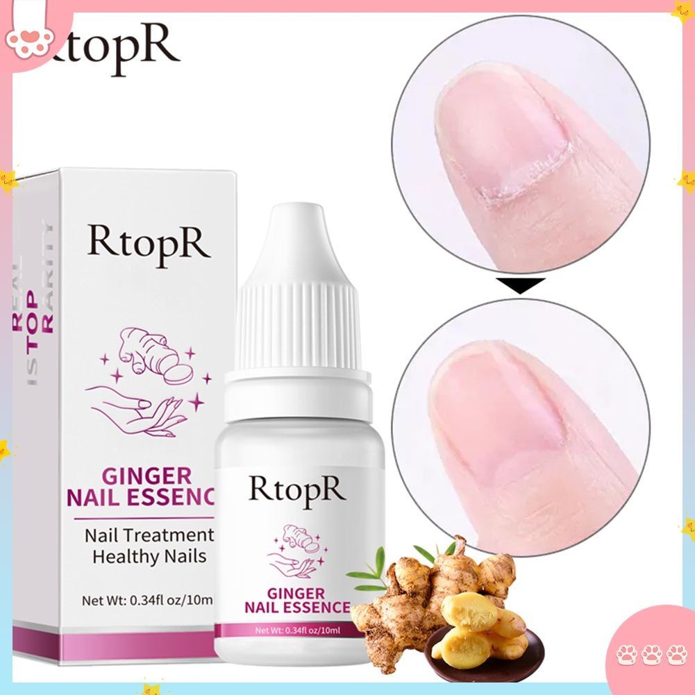 COD Rtopr Ginger Antibacterial Nail Treatment Essential Anti Fungal ...