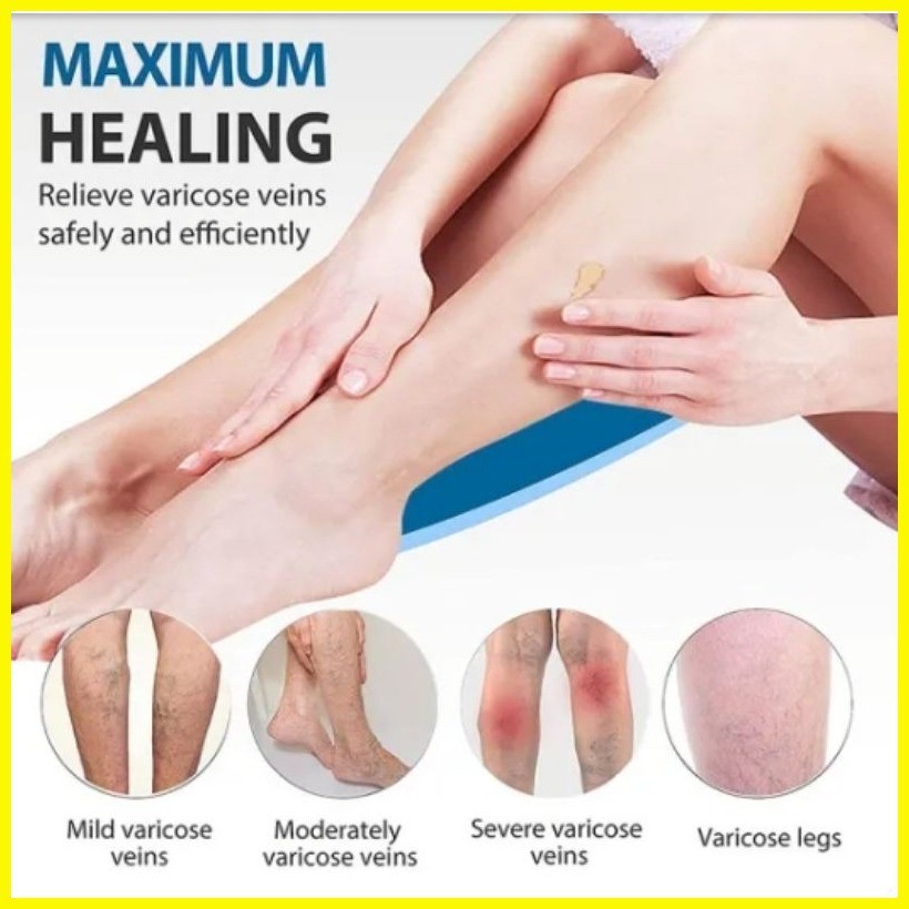 ♞Korean ginseng oil 300ml Warts removal varicose veins pasma lamig SA