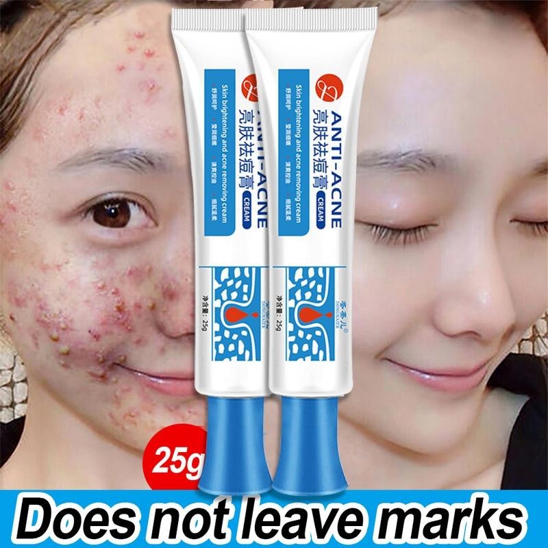 AntiAcne Cream Acne Treatment Gel Pimple Remover Cream Scars Remover