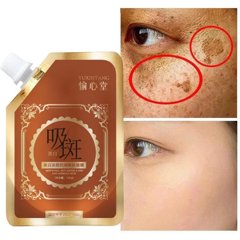 Freckle Mask Dark Spots Remover Melasma Mask Peeling Mask Fade Dark ...
