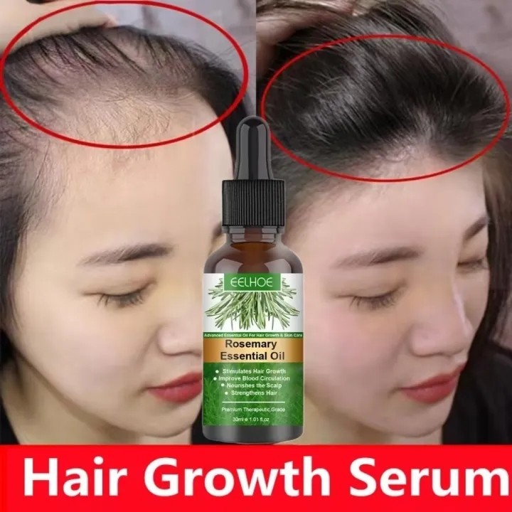 Rosemary Essential Oil Hair Growth Essence Serum Hair Growth Serum Fast ...