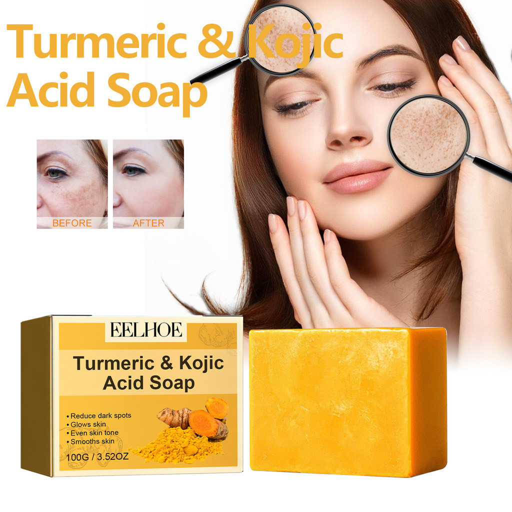 Turmeric Soap Bar,Organic Turmeric Soap for Dark Spots & Acne, Turmeric ...