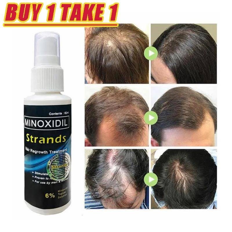 Minoxidil Hair Grower Original 60ml Minoxidil Strands Hair Beard ...