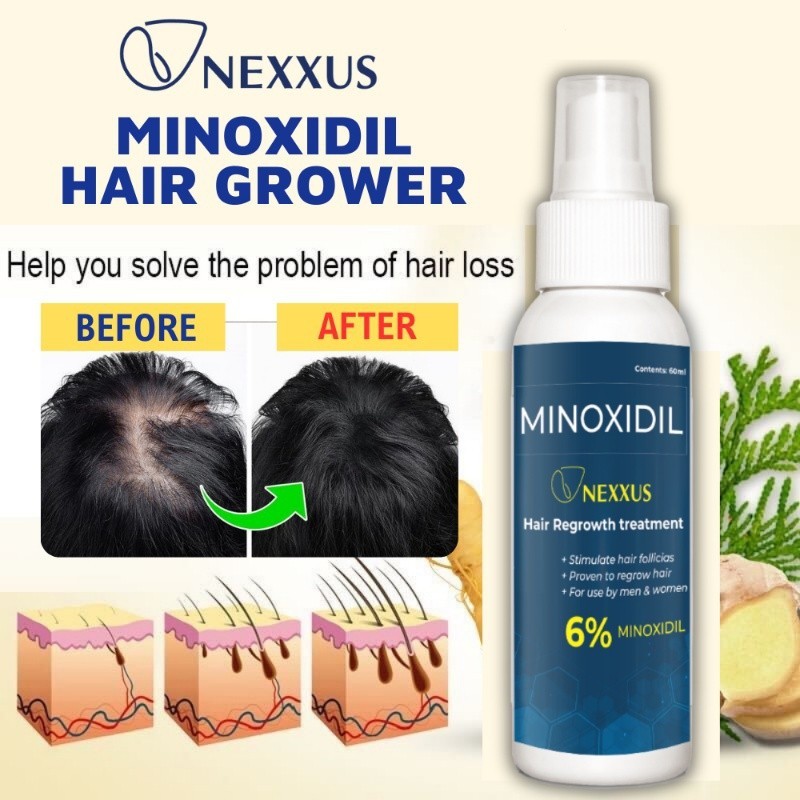 Minoxidil Hair Grower Nexxus Minoxidil spray regowth treatment ...